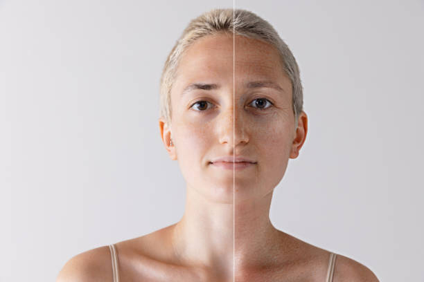 De zon en huidveroudering