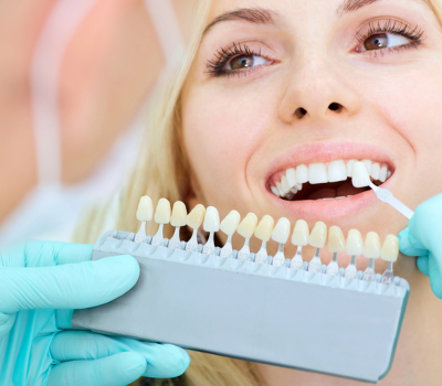Hoe houd je je tanden langer wit na een cosmetische tandenbleking?