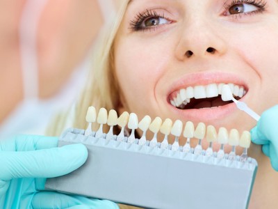 Hoe houd je je tanden langer wit na een cosmetische tandenbleking?