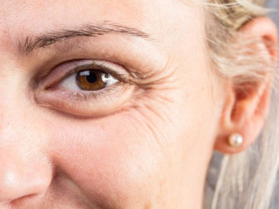 5 Tips Om Rimpels Te Voorkomen