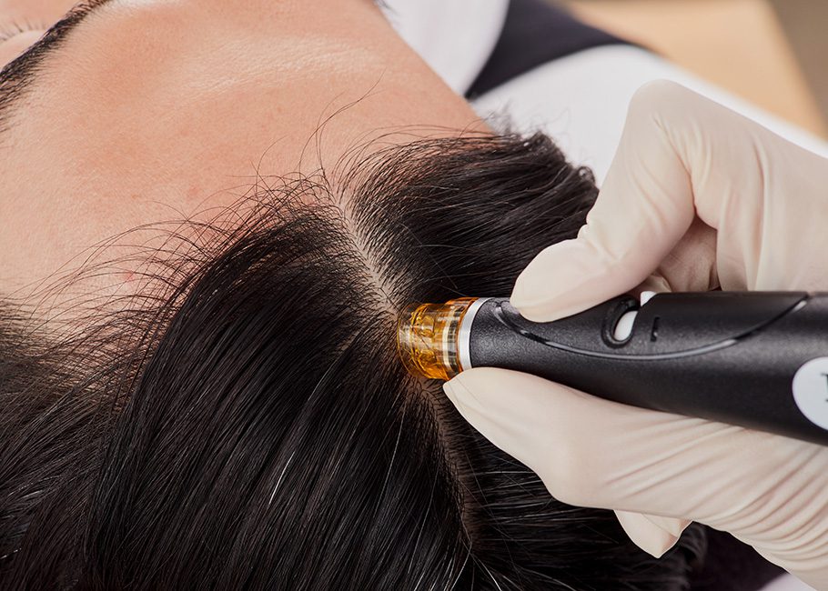 Maak kennis met HydraFacial Keravive voor een gezonde hoofdhuid