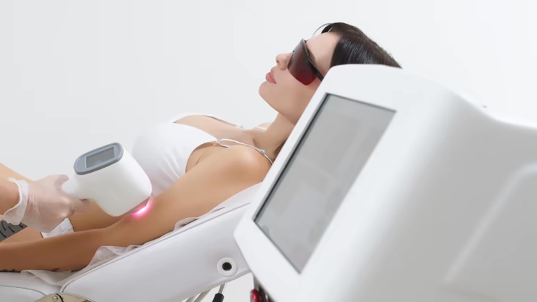 Kosten van laserontharing in Antwerpen: wat je moet weten