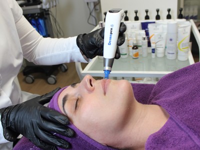 Mesotherapie/Dermapen