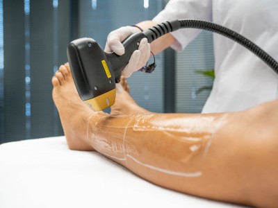 Pakketten laserontharing