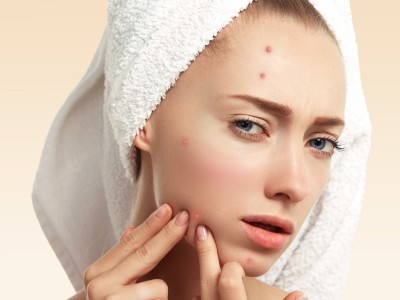 Puistjes na een gezichtsbehandeling?