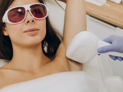 Hoe lang blijft haar weg na laserontharing? 