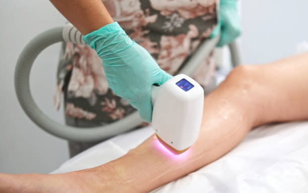 Hoe onthaar ik best? IPL of Laserontharing?